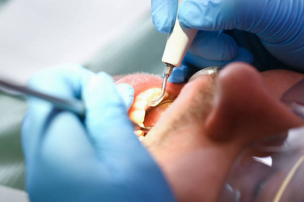 Best Emergency Root Canal Therapy in Manteno, IL
